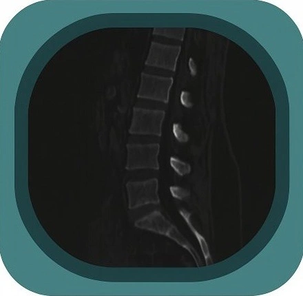 CT L spine  anatomy icon